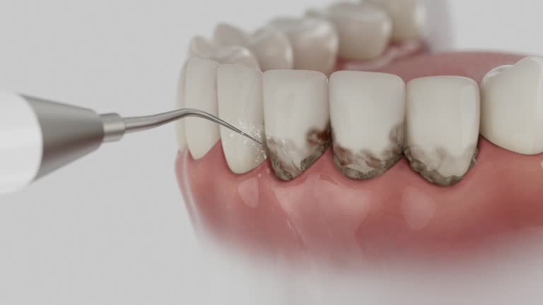 Trusted Tooth Extraction service in Mitchellville, MD - Dentist Open Now